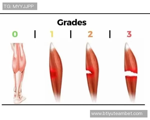 肌肉拉伤恢复指南:轻度1到2周重度需手术停训至少三个月 肌肉拉伤恢复指南:轻度1到2周重度需手术停训至少三个月